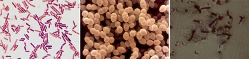 Escherichia coli, enterococo fecal e proteus son as principais causas dunha prostatite bacteriana crónica