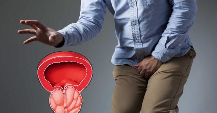 Prevención de prostatite e próstata -adenoma